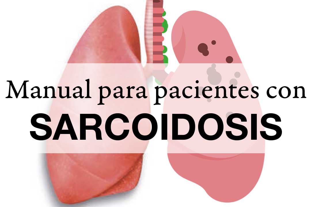 Manual para pacientes con Sarcoidosis